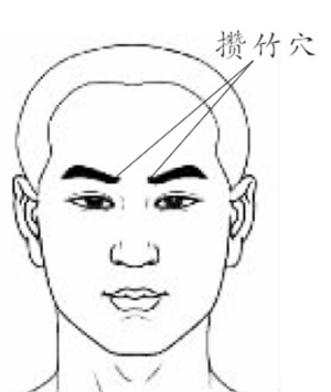 攒竹穴的位置在眉毛内侧边缘的凹陷处(如上图),点按方法非常简单: 将